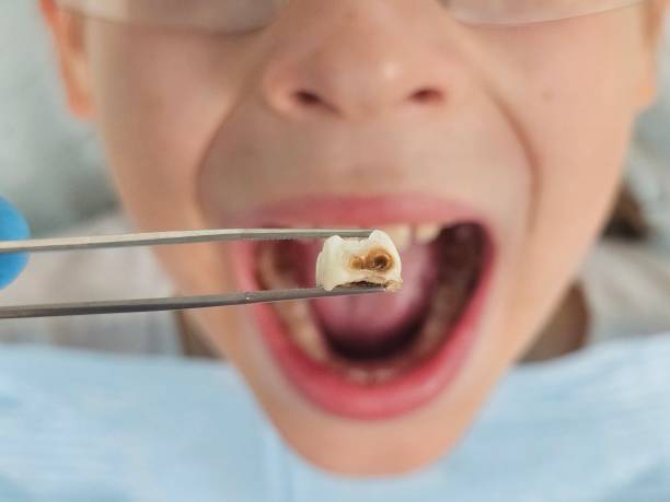 Best Emergency Treatment for Toothache in Wyndham, VA