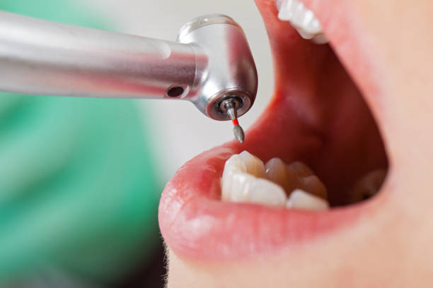 Best Emergency Treatment for Toothache in Wyndham, VA